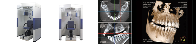歯科用CTによる精密で安全な歯科診断
